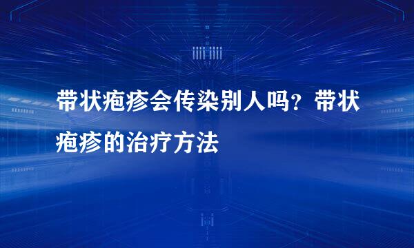 带状疱疹会传染别人吗？带状疱疹的治疗方法
