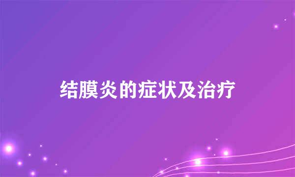 结膜炎的症状及治疗
