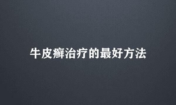 牛皮癣治疗的最好方法
