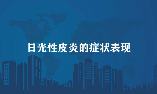 日光性皮炎的症状表现