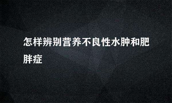 怎样辨别营养不良性水肿和肥胖症
