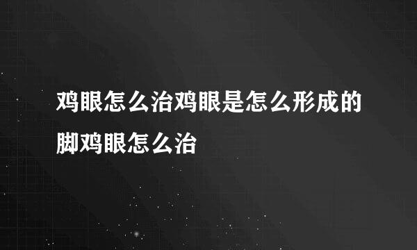 鸡眼怎么治鸡眼是怎么形成的脚鸡眼怎么治