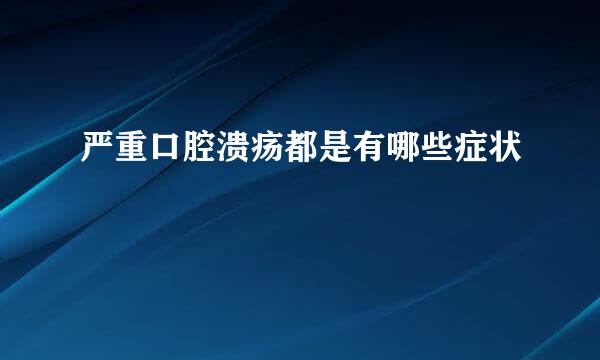 严重口腔溃疡都是有哪些症状