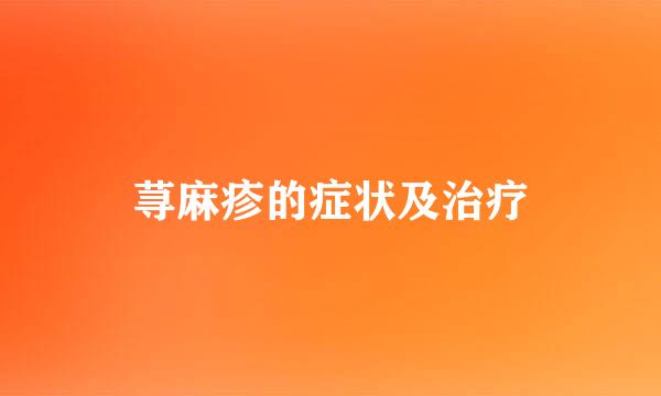 荨麻疹的症状及治疗