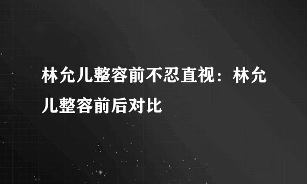 林允儿整容前不忍直视：林允儿整容前后对比