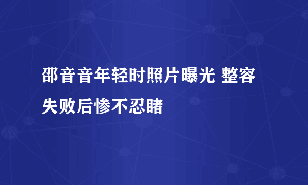 邵音音年轻时照片曝光 整容失败后惨不忍睹
