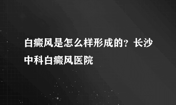 白癜风是怎么样形成的？长沙中科白癜风医院