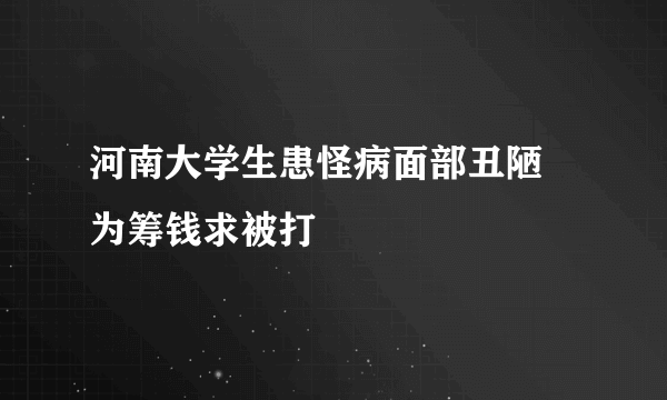 河南大学生患怪病面部丑陋 为筹钱求被打