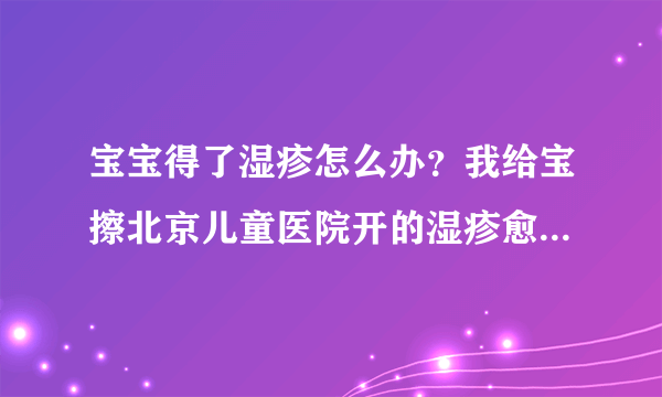 宝宝得了湿疹怎么办？我给宝擦北京儿童医院开的湿疹愈乳膏可好使了