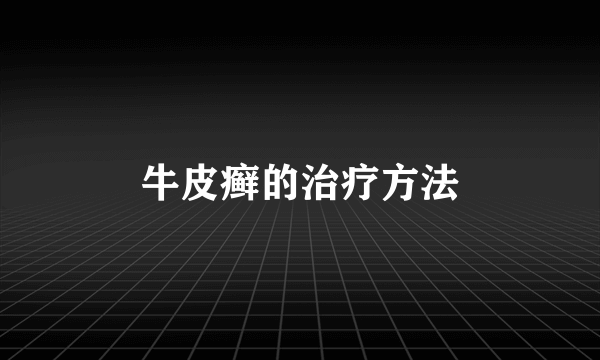 牛皮癣的治疗方法