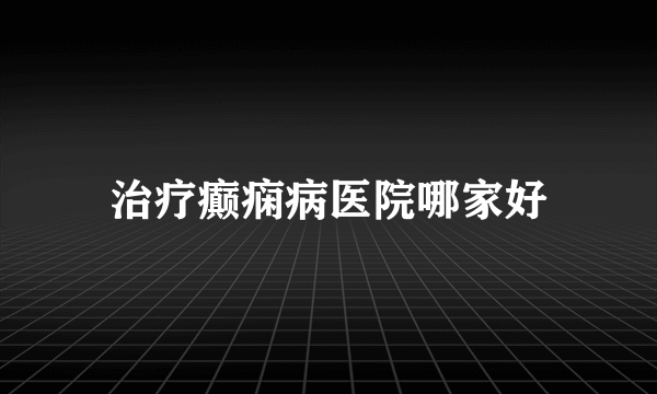 治疗癫痫病医院哪家好