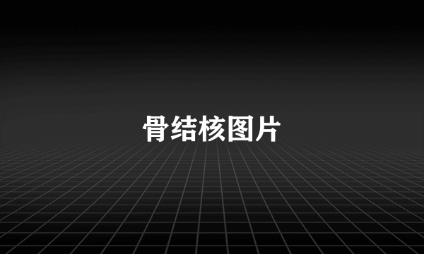 骨结核图片