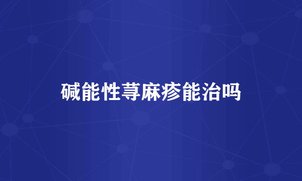 碱能性荨麻疹能治吗