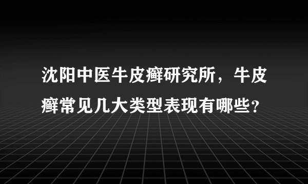 沈阳中医牛皮癣研究所，牛皮癣常见几大类型表现有哪些？