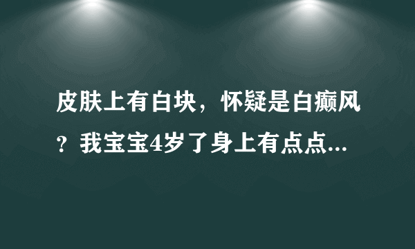 皮肤上有白块，怀疑是白癫风？我宝宝4岁了身上有点点白...
