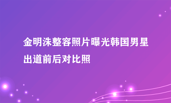 金明洙整容照片曝光韩国男星出道前后对比照