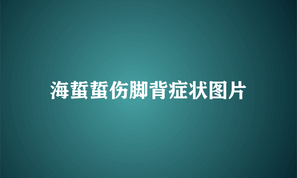 海蜇蜇伤脚背症状图片