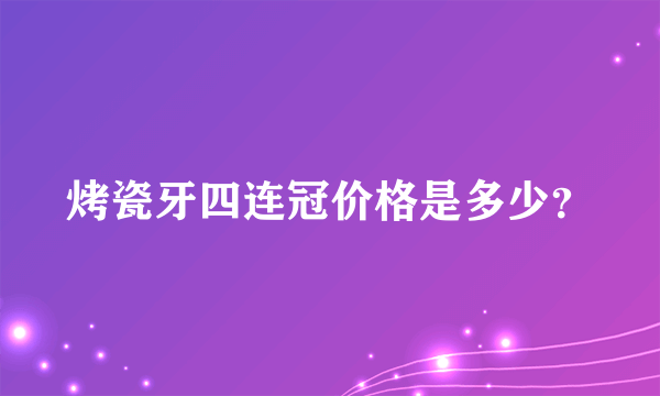 烤瓷牙四连冠价格是多少？