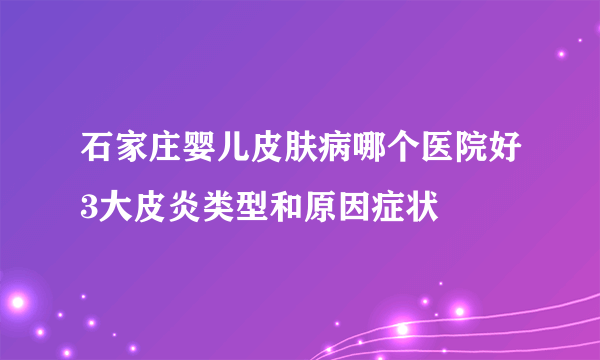 石家庄婴儿皮肤病哪个医院好3大皮炎类型和原因症状