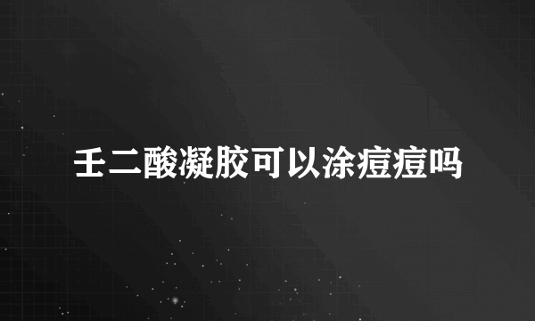 壬二酸凝胶可以涂痘痘吗