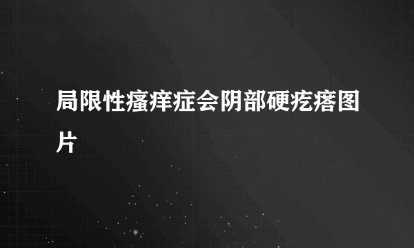 局限性瘙痒症会阴部硬疙瘩图片