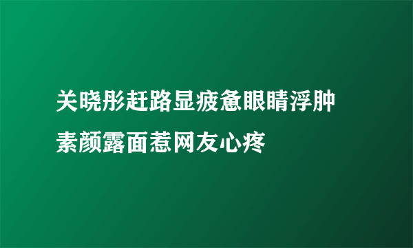 关晓彤赶路显疲惫眼睛浮肿    素颜露面惹网友心疼
