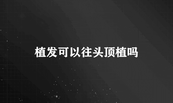 植发可以往头顶植吗