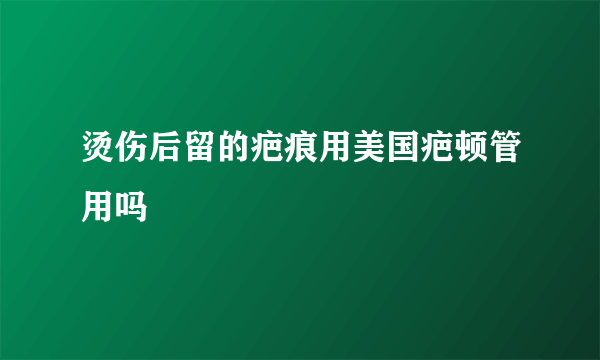 烫伤后留的疤痕用美国疤顿管用吗