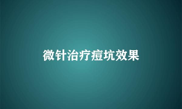 微针治疗痘坑效果
