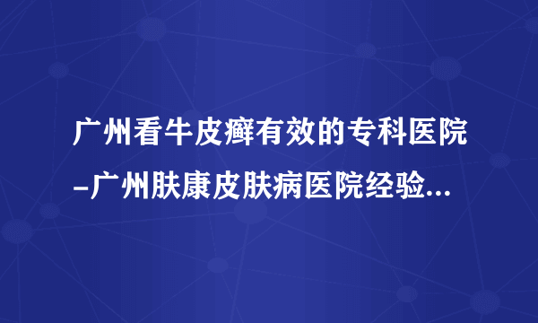 广州看牛皮癣有效的专科医院-广州肤康皮肤病医院经验丰富，服务优质