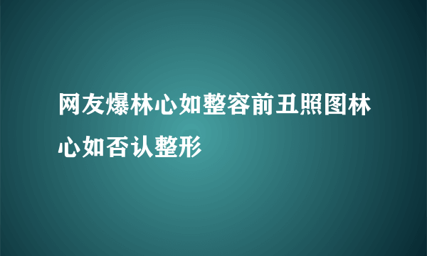 网友爆林心如整容前丑照图林心如否认整形