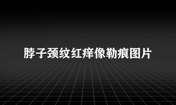 脖子颈纹红痒像勒痕图片